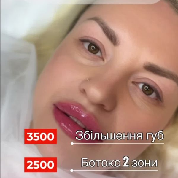 Любі дівчата для вас акційні пропозиції на найтоповіші процедури в квітні 🔥
18.0